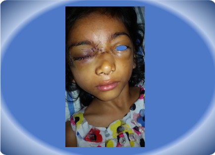 MAXILLOFACIAL INJURY
